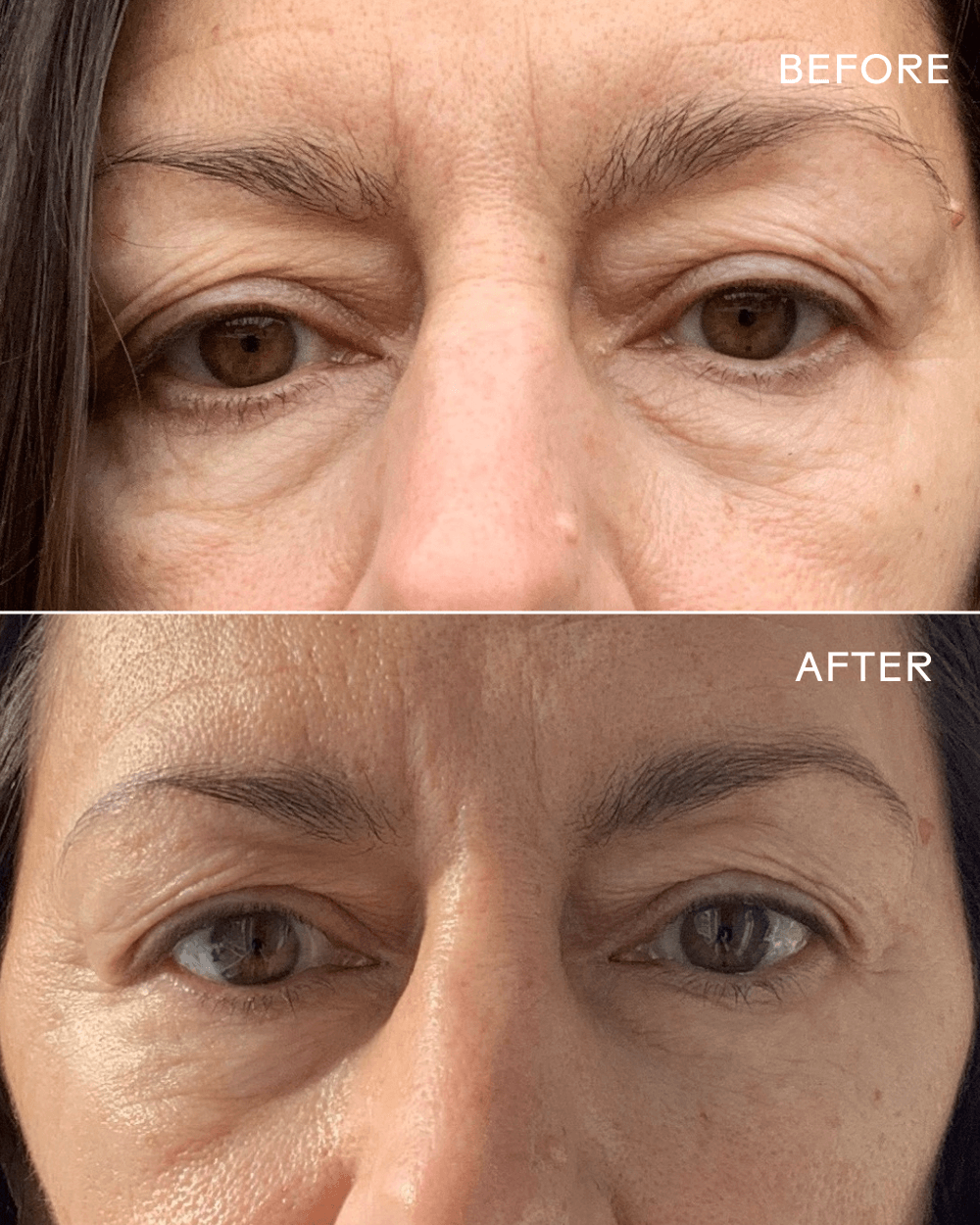 Before and after results showcasing the effectiveness of First Light Vitamin C + Caffeine Eye Cream on reducing dark circles.