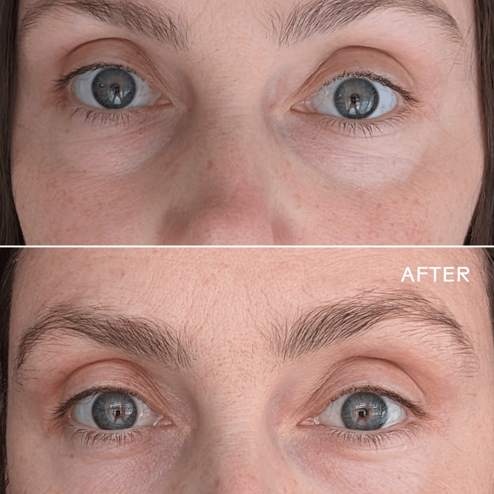 Before and after results showing under-eye brightness improvement with First Light Vitamin C + Caffeine Eye Cream.