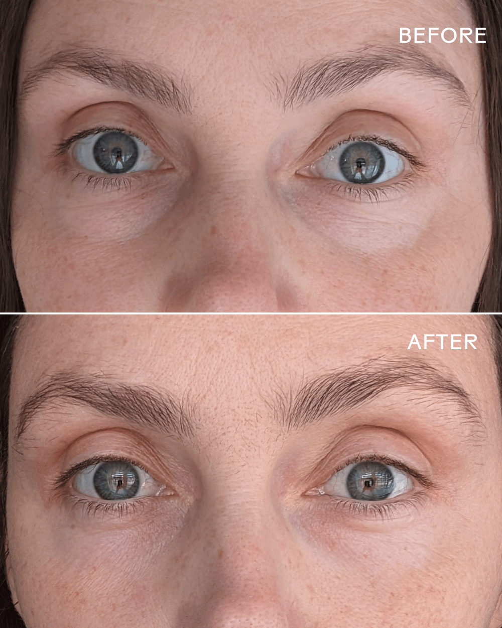 Before and after results showing under-eye brightness improvement with First Light Vitamin C + Caffeine Eye Cream.